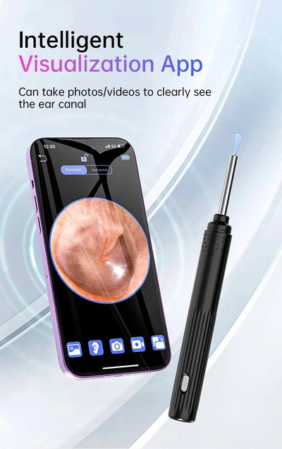 KERUI Ear Wax Removal Cleaner With 5MP HD Camera - See Ear Canal Add Hooks - stepyours.com