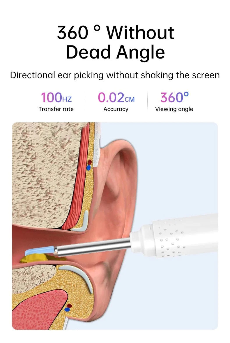 KERUI Ear Wax Removal Cleaner With 5MP HD Camera - See Ear Canal Add Hooks - stepyours.com