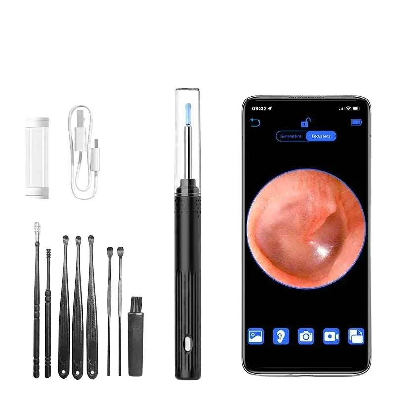 KERUI Ear Wax Removal Cleaner With 5MP HD Camera - See Ear Canal Add Hooks - stepyours.com