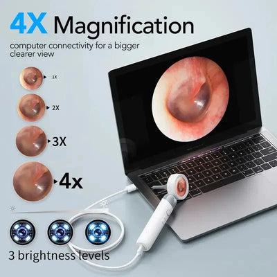 Smart Ear Endoscope For Home Health Checks At Home - Enovarah