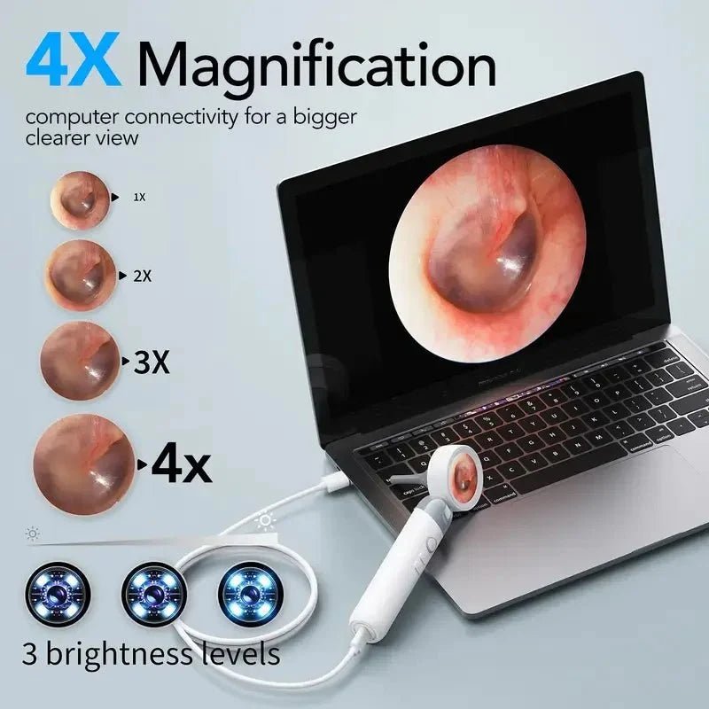 Smart Ear Endoscope For Home Health Checks At Home - Enovarah